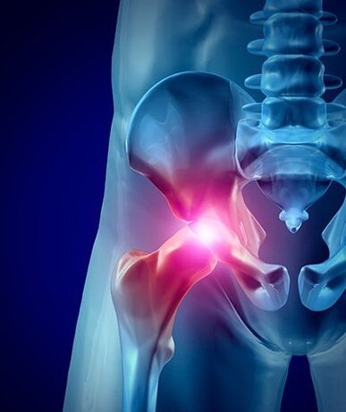 Foto de dor de cadeira 1