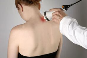 Fisioterapia para osteocondrose