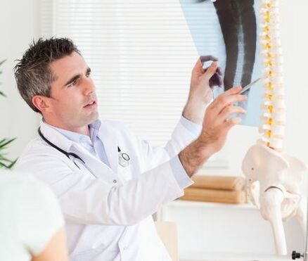 O médico pode diagnosticar a osteocondrose mediante un exame de raios X.